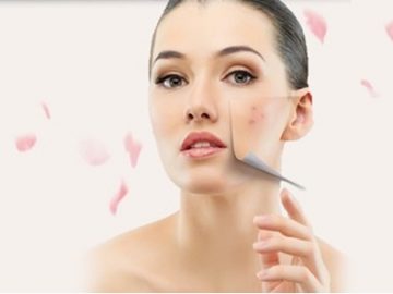 phai-tri-mun-tan-goc-moi-hieu-qua