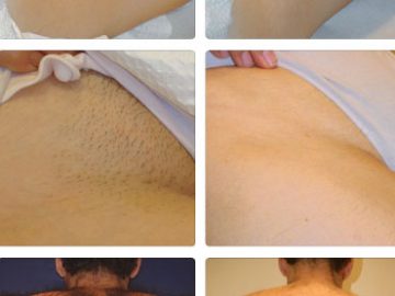 triet-long-voi-cong-nghe-moi-5g